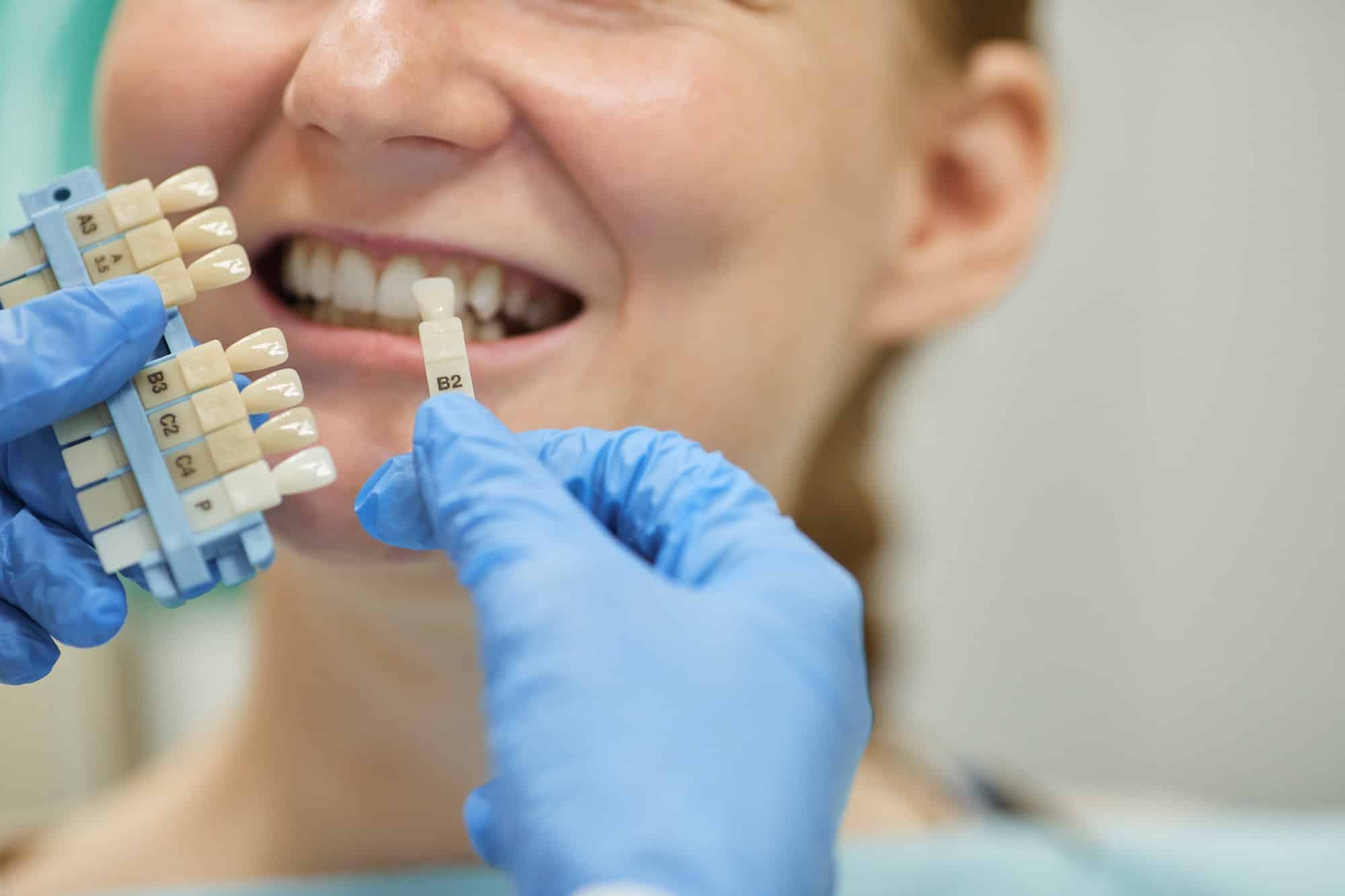 Dental implants for patient